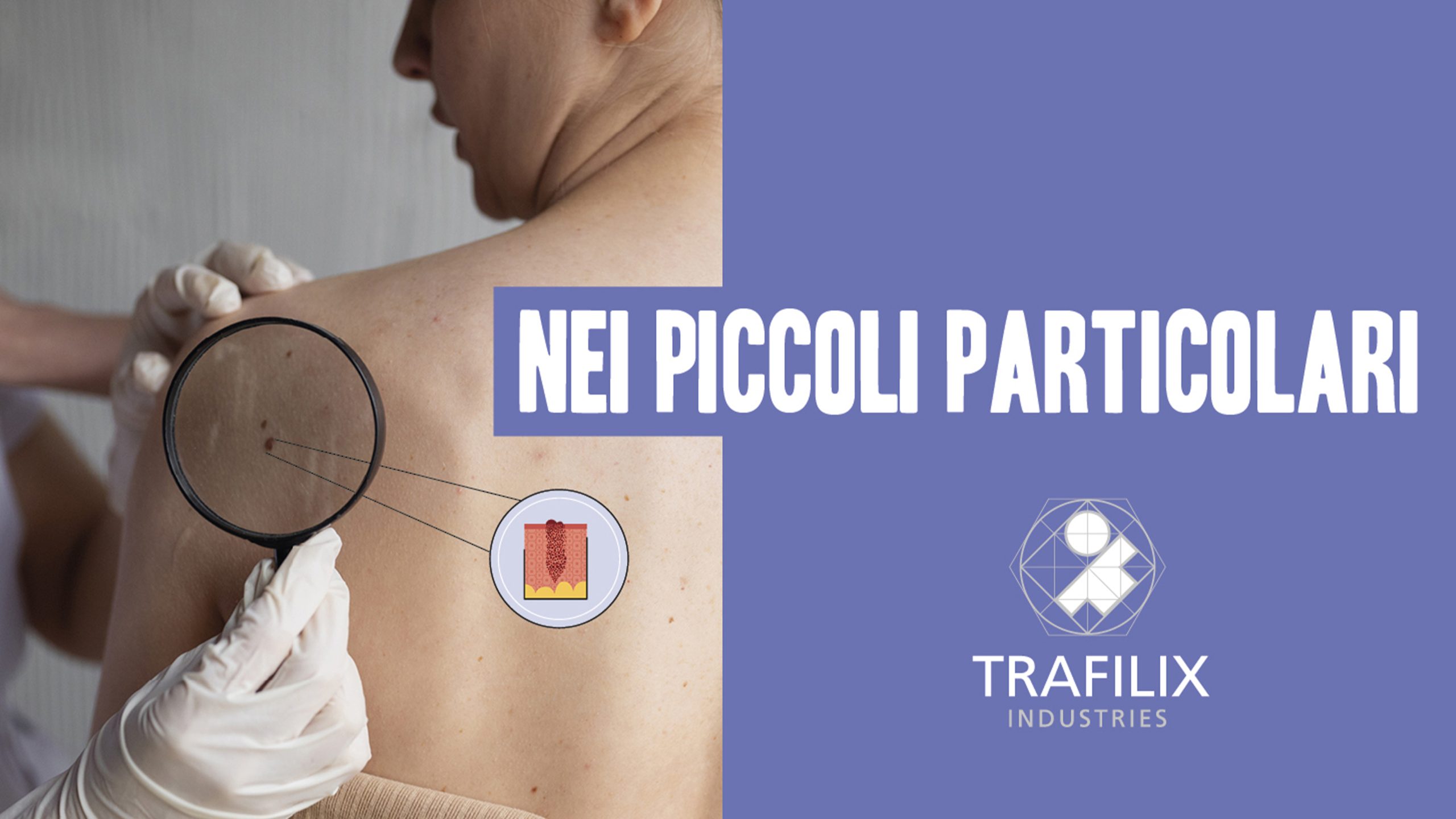 NEI PICCOLI PARTICOLARI – SCREENING PER LA PREVENZIONE DEL MELANOMA CUTANEO